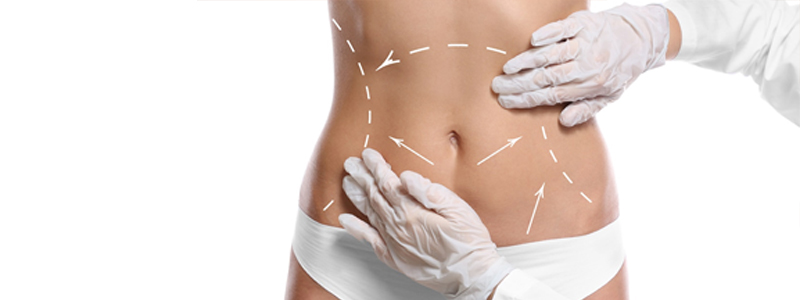 Essencial no Pós-operatório de Cirurgias Plásticas